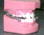 Teeth Jaw Sample